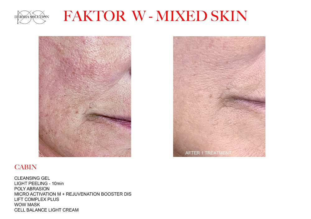 FAKTOR W   MIXED SKIN   6