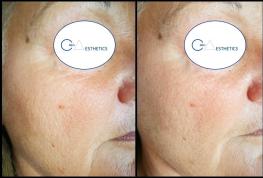 cc5f7efd d4c1 48a3 9395 c7ee39ad2bbd original