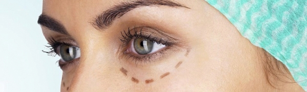 nososleznaya borozda