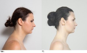 Sejas Fitness rezultāti 