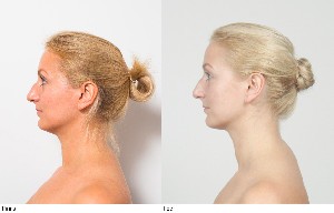 Sejas Fitness rezultāti 