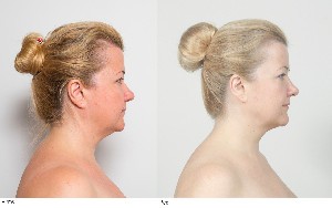 Sejas Fitness rezultāti 