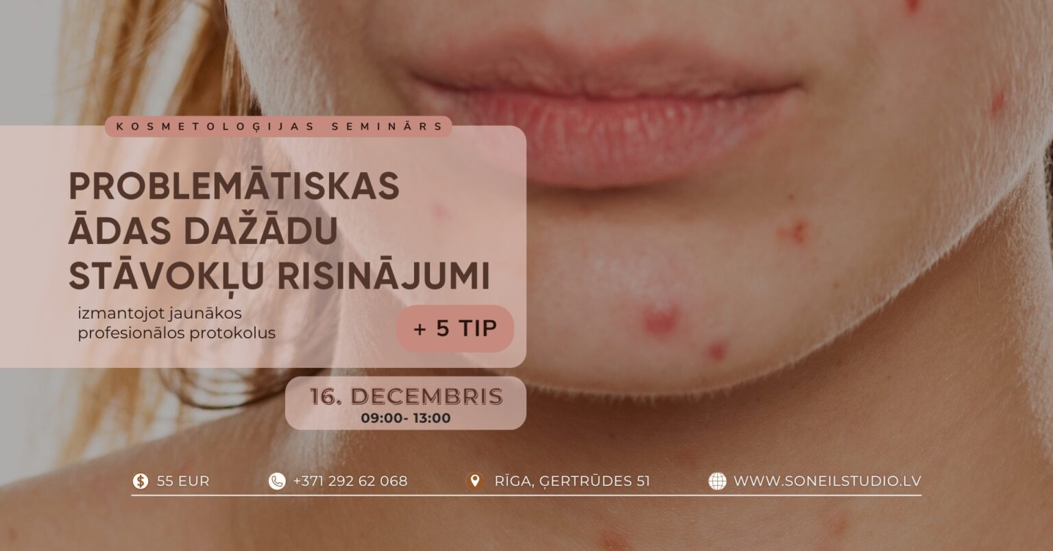 16-decembris-9-13-1536x804 16-decembris-9-13-1536x804