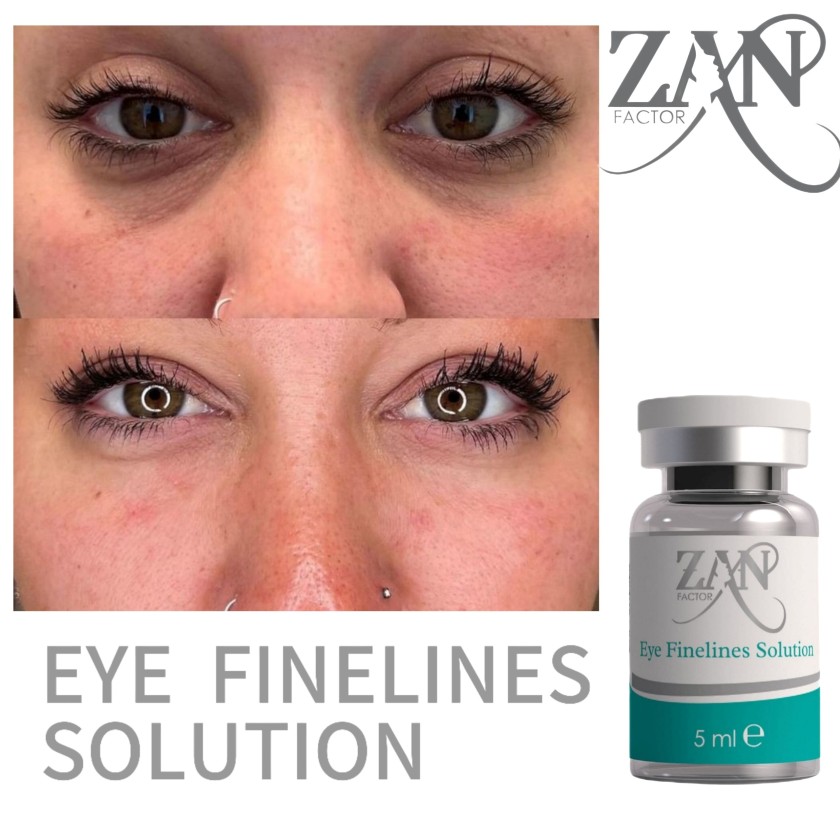 zeneyes zeneyes