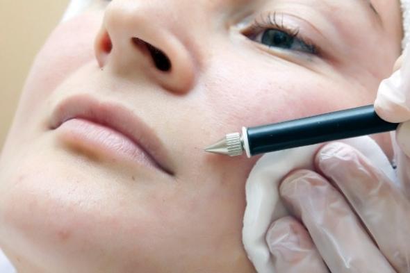 etot-vid-epilyatsii-mozhet-byt-ispolzovan-dazhe-dlya-litsa-min